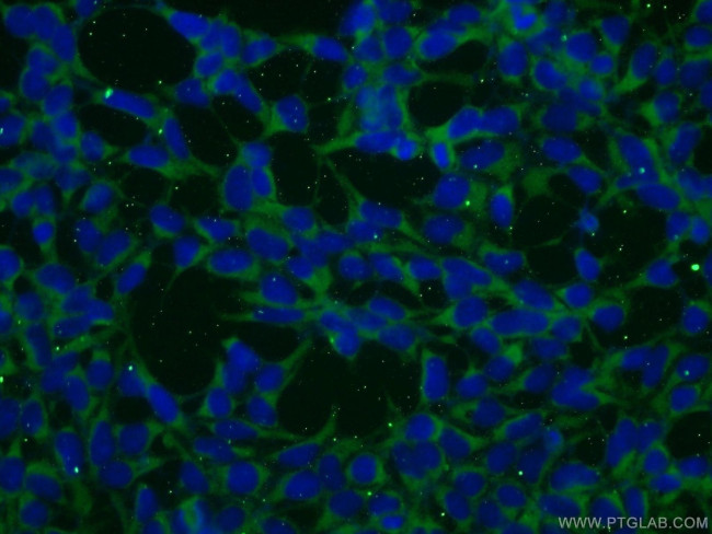 BAALC Antibody in Immunocytochemistry (ICC/IF)