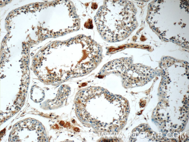 BAALC Antibody in Immunohistochemistry (Paraffin) (IHC (P))