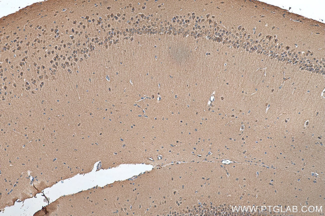 BAALC Antibody in Immunohistochemistry (Paraffin) (IHC (P))