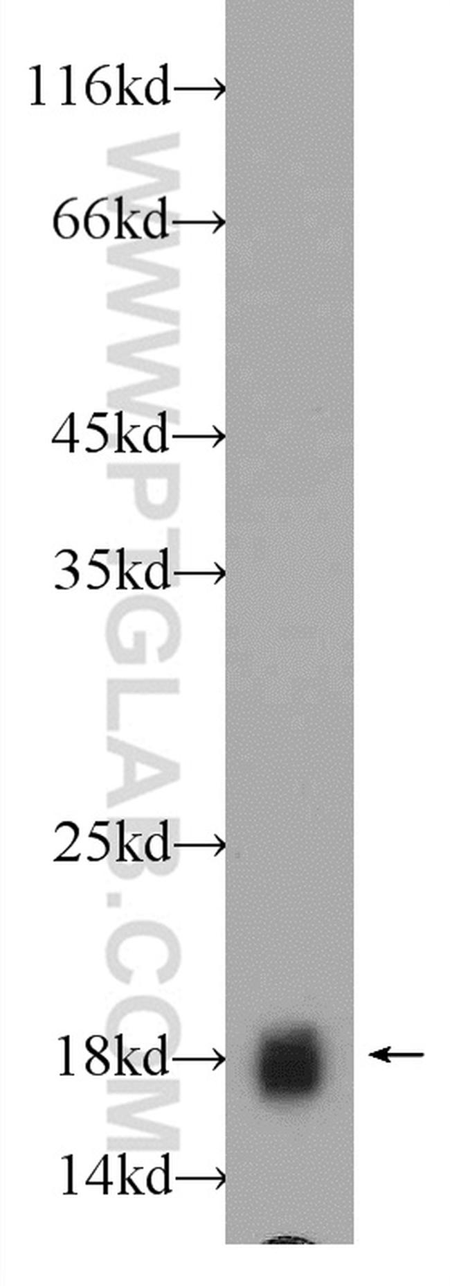 BAALC Antibody in Western Blot (WB)