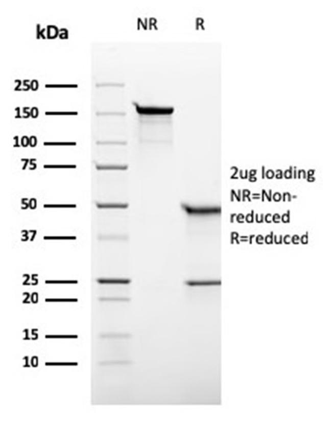 Alkaline Phosphatase (Placental)/PLAP (Germ Cell Tumor Marker) Antibody in Immunoelectrophoresis (IE)