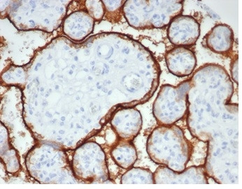 Alkaline Phosphatase (Placental)/PLAP (Germ Cell Tumor Marker) Antibody in Immunohistochemistry (Paraffin) (IHC (P))