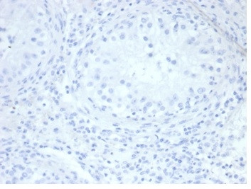 Alkaline Phosphatase (Placental)/PLAP (Germ Cell Tumor Marker) Antibody in Immunohistochemistry (Paraffin) (IHC (P))