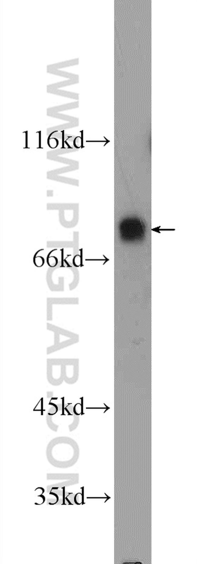 SP2 Antibody in Western Blot (WB)