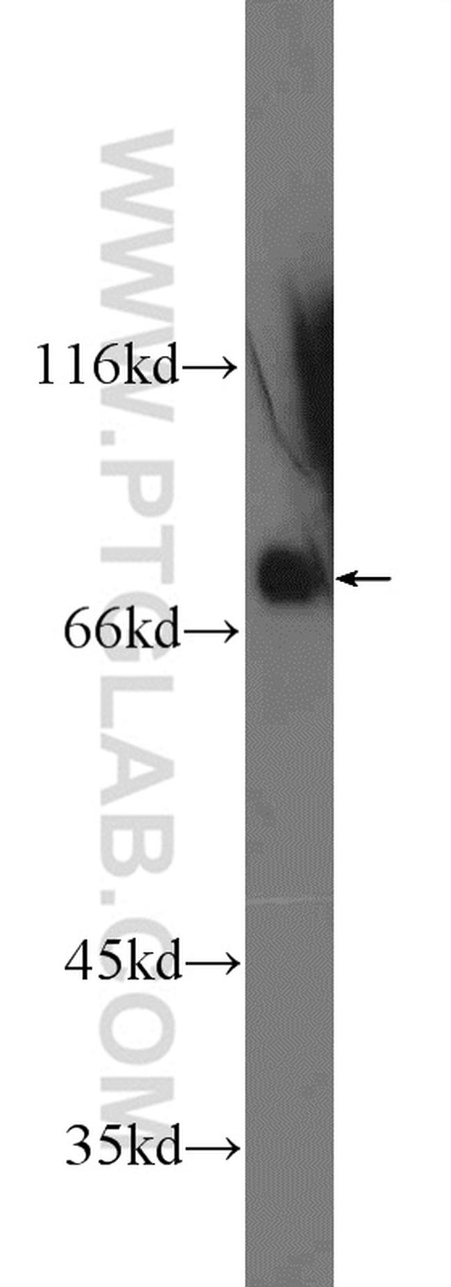 SP2 Antibody in Western Blot (WB)