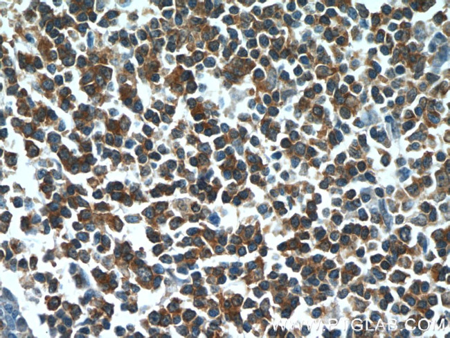 HCLS1 Antibody in Immunohistochemistry (Paraffin) (IHC (P))