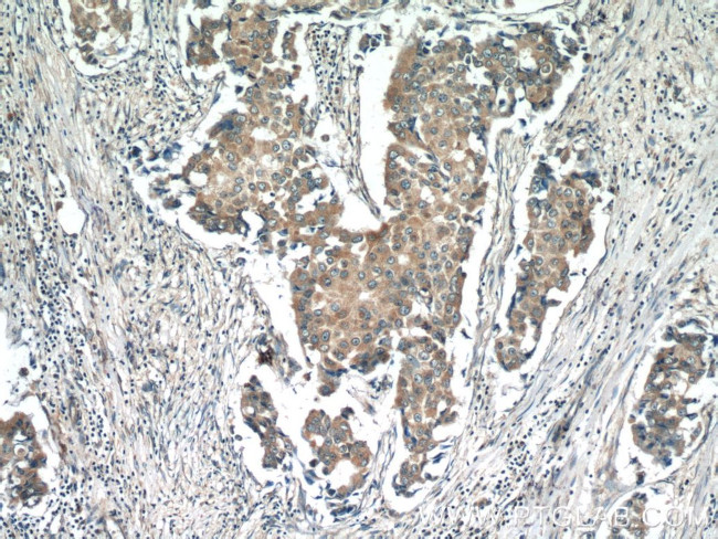 FGFBP1 Antibody in Immunohistochemistry (Paraffin) (IHC (P))