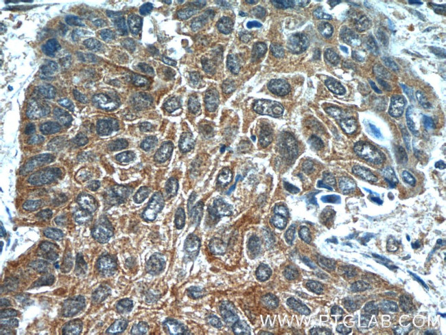 FGFBP1 Antibody in Immunohistochemistry (Paraffin) (IHC (P))