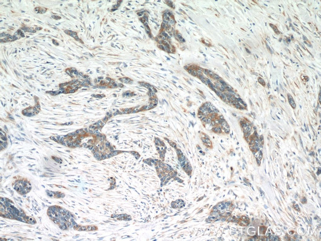 FGFBP1 Antibody in Immunohistochemistry (Paraffin) (IHC (P))