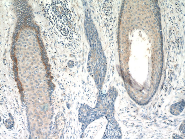 FGFBP1 Antibody in Immunohistochemistry (Paraffin) (IHC (P))