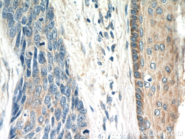 FGFBP1 Antibody in Immunohistochemistry (Paraffin) (IHC (P))