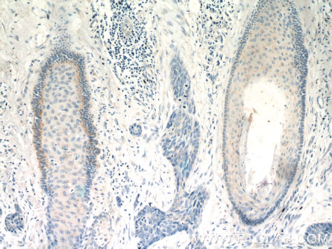 FGFBP1 Antibody in Immunohistochemistry (Paraffin) (IHC (P))