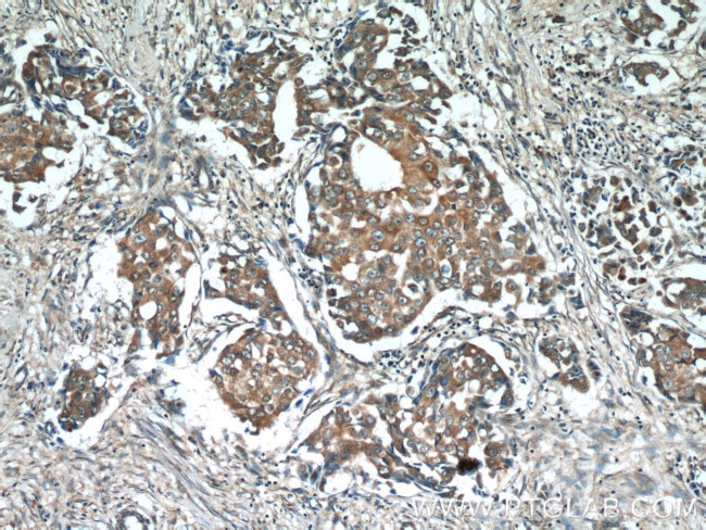 FGFBP1 Antibody in Immunohistochemistry (Paraffin) (IHC (P))