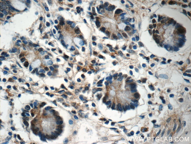 ZC3H12A Antibody in Immunohistochemistry (Paraffin) (IHC (P))