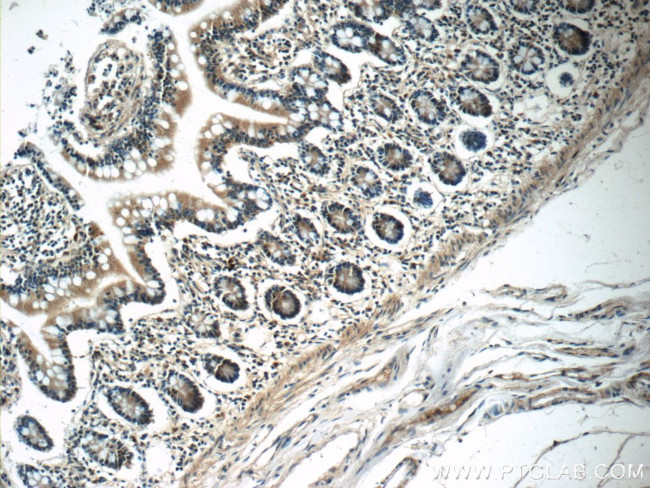 ZC3H12A Antibody in Immunohistochemistry (Paraffin) (IHC (P))