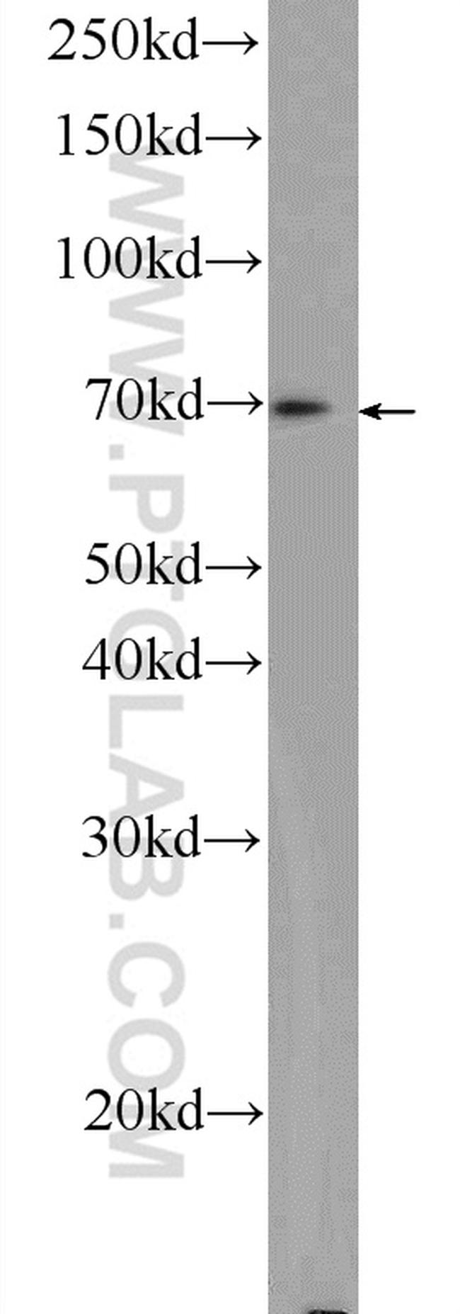 ZC3H12A Antibody in Western Blot (WB)