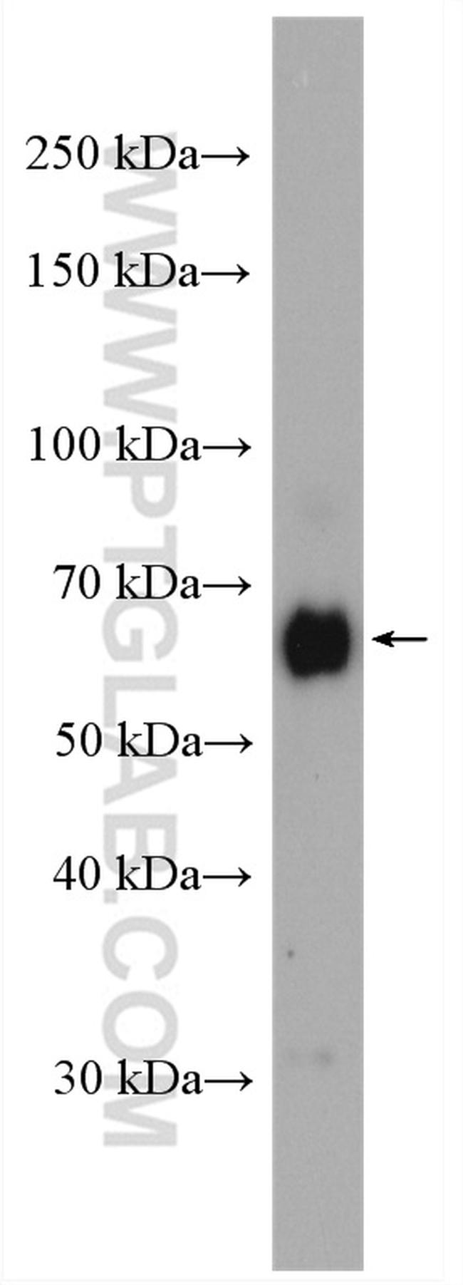 ZC3H12A Antibody in Western Blot (WB)