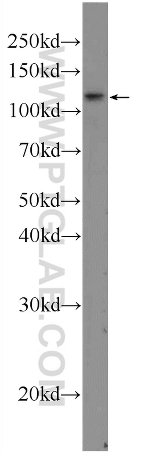 TSHZ3 Antibody in Western Blot (WB)