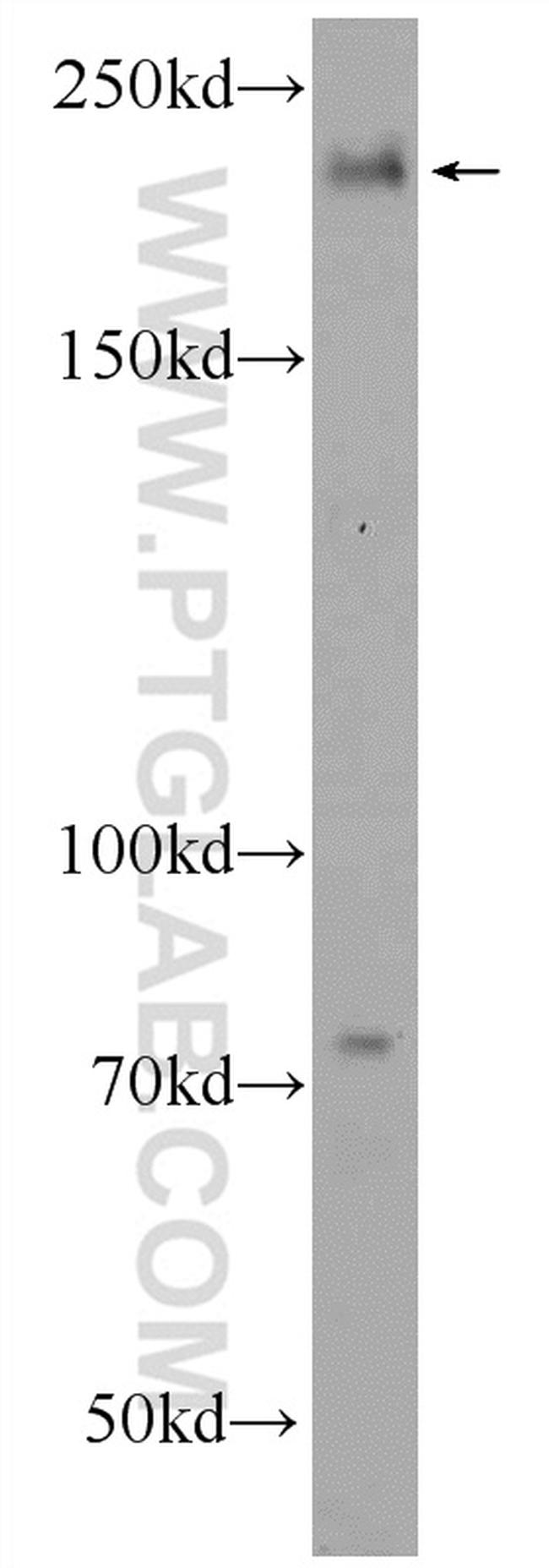 GCP6 Antibody in Western Blot (WB)