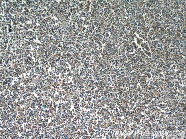 RelB Antibody in Immunohistochemistry (Paraffin) (IHC (P))