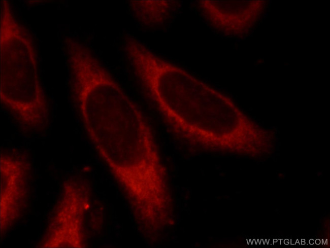 RelB Antibody in Immunocytochemistry (ICC/IF)