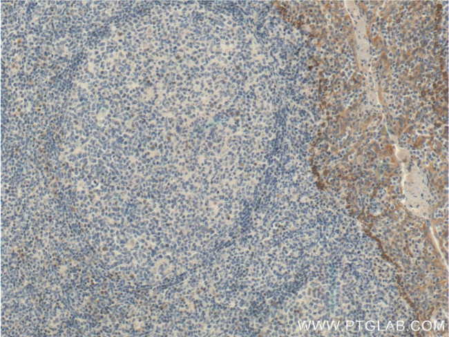 MSC Antibody in Immunohistochemistry (Paraffin) (IHC (P))