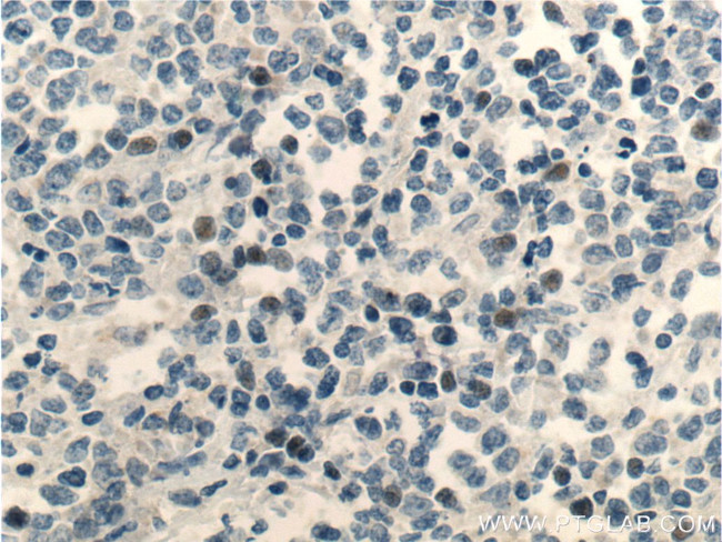 MSC Antibody in Immunohistochemistry (Paraffin) (IHC (P))