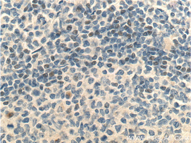 MSC Antibody in Immunohistochemistry (Paraffin) (IHC (P))