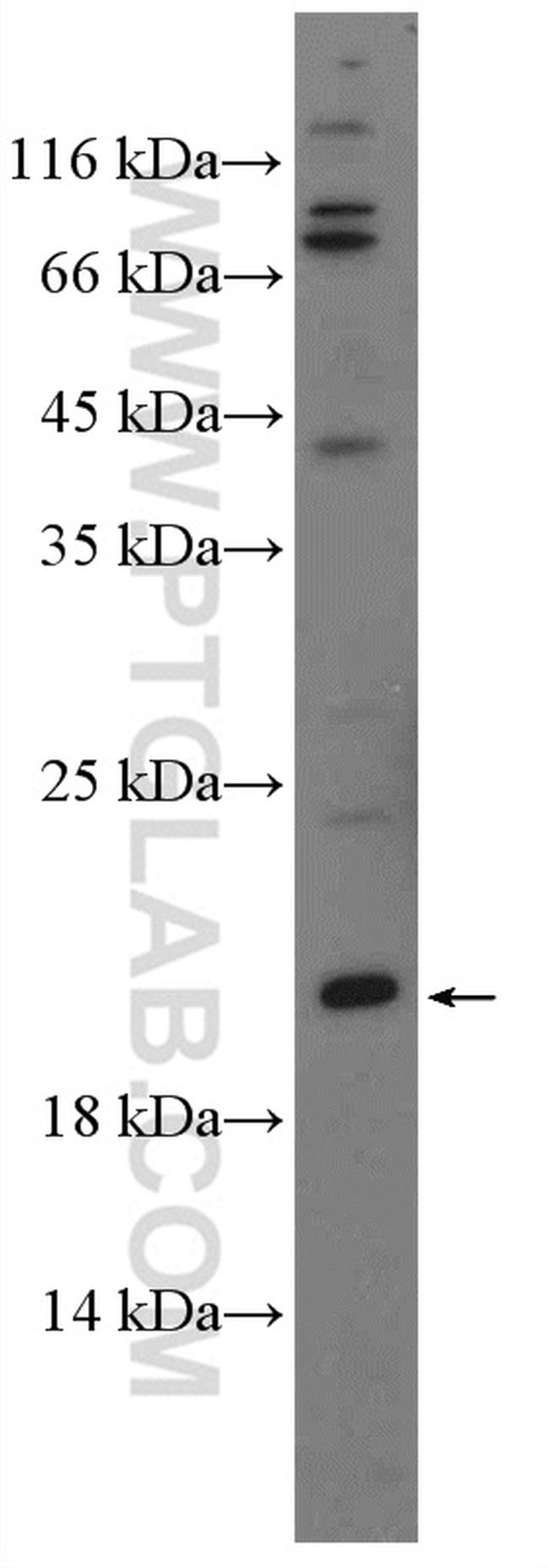 MSC Antibody in Western Blot (WB)