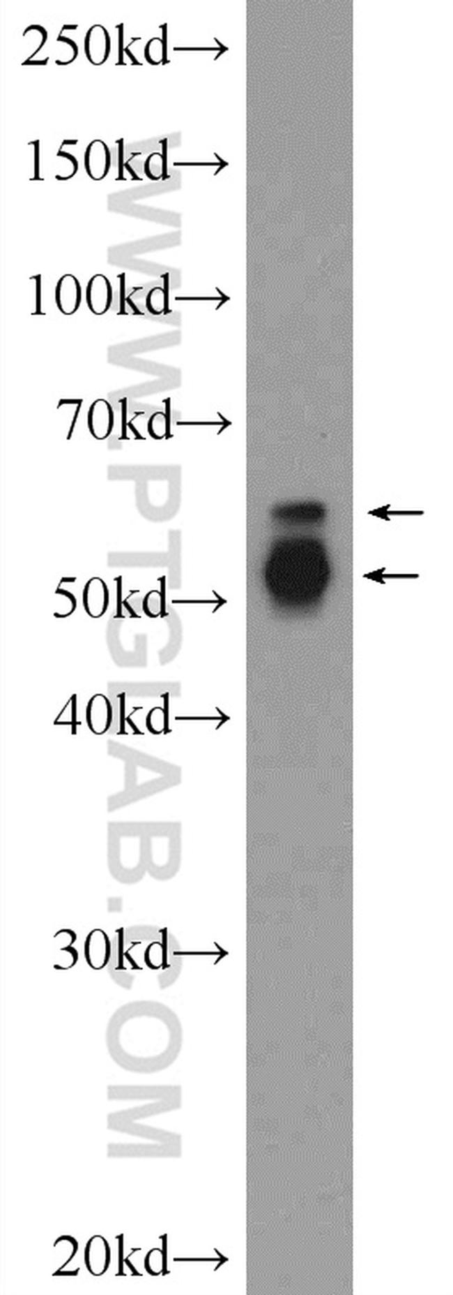 PAG1 Antibody in Western Blot (WB)