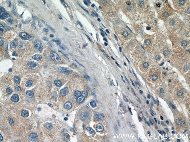 ARMETL1 Antibody in Immunohistochemistry (Paraffin) (IHC (P))