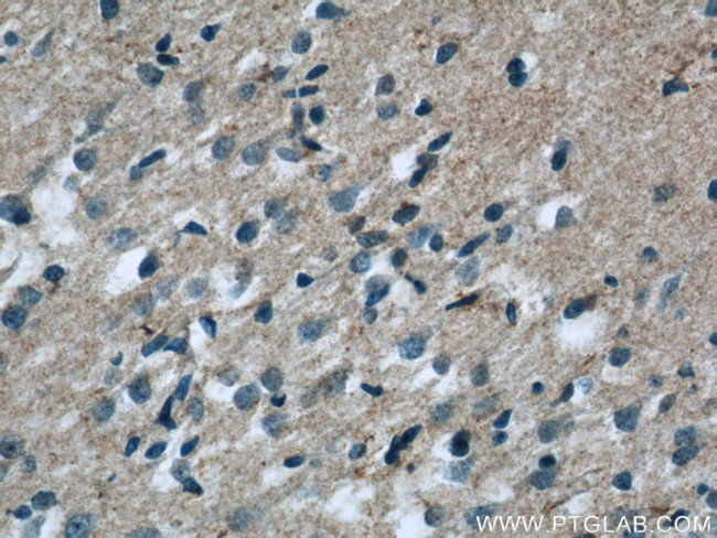 ARMETL1 Antibody in Immunohistochemistry (Paraffin) (IHC (P))