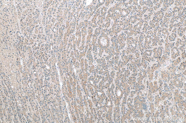 ARMETL1 Antibody in Immunohistochemistry (Paraffin) (IHC (P))