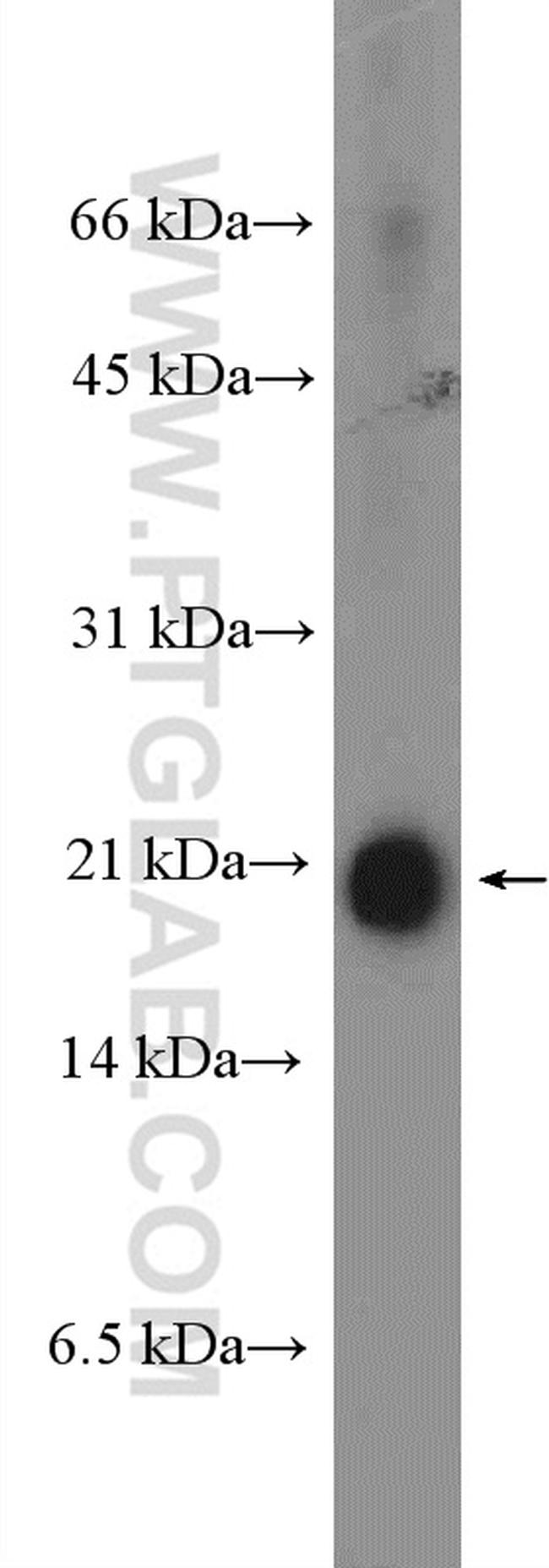 ARMETL1 Antibody in Western Blot (WB)