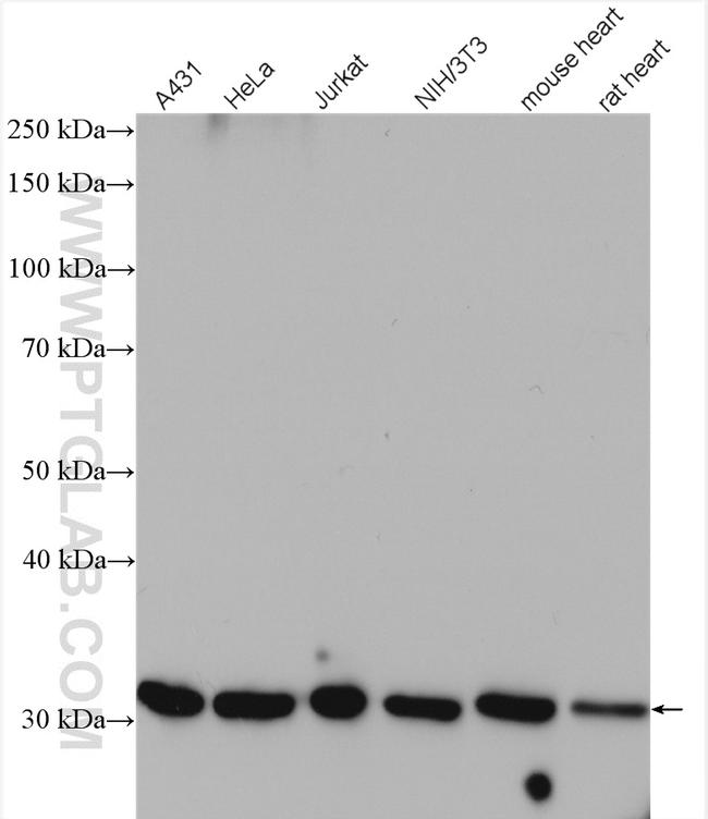 CAPZB Antibody in Western Blot (WB)