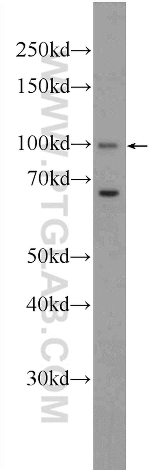 CCDC40 Antibody in Western Blot (WB)