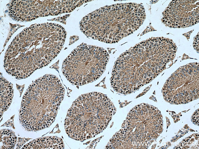 C19orf57 Antibody in Immunohistochemistry (Paraffin) (IHC (P))