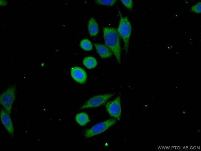 C19orf57 Antibody in Immunocytochemistry (ICC/IF)