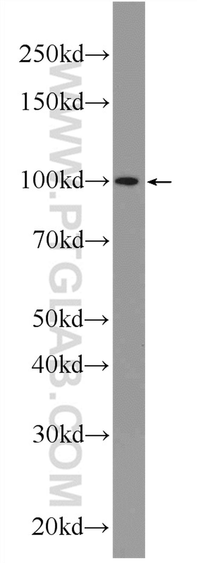 C19orf57 Antibody in Western Blot (WB)