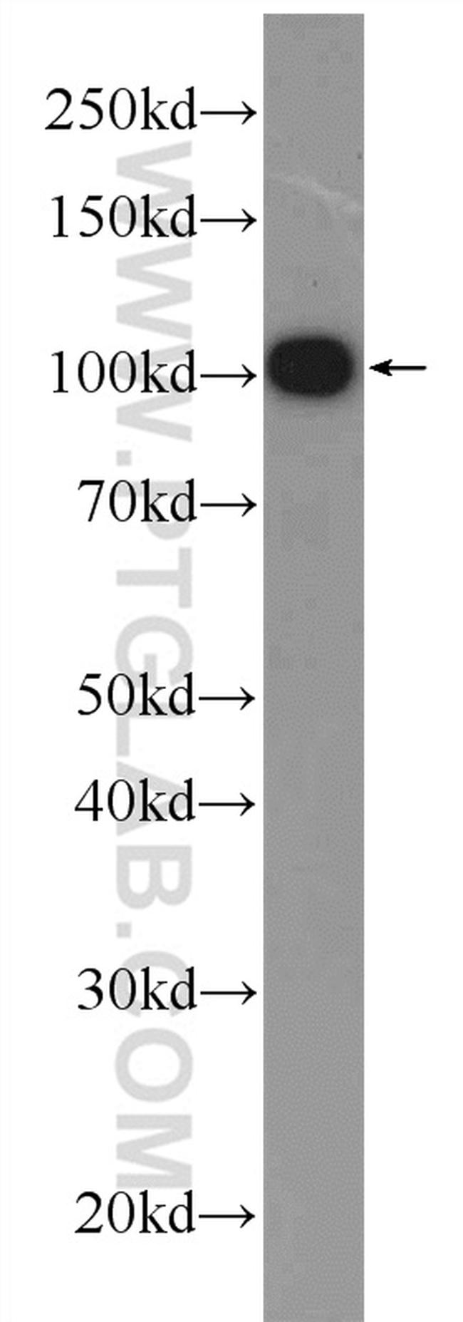 C19orf57 Antibody in Western Blot (WB)