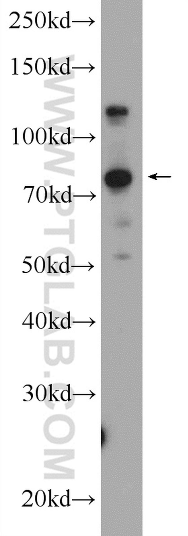 KIAA1530 Antibody in Western Blot (WB)