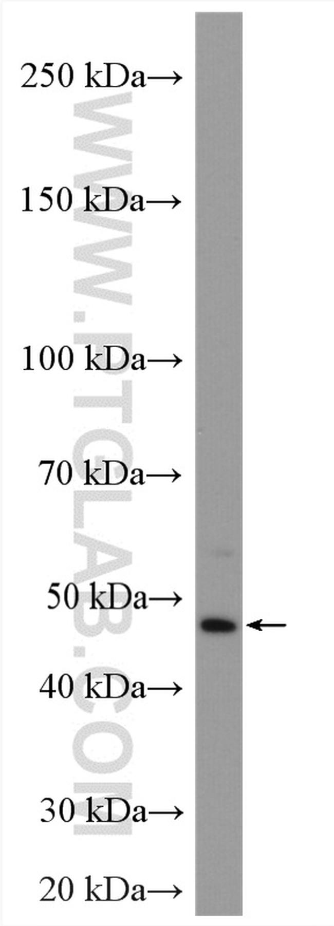 NR1H4 Antibody in Western Blot (WB)