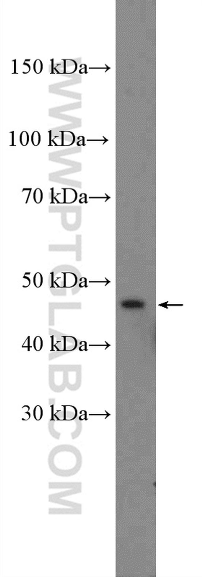 NR1H4 Antibody in Western Blot (WB)