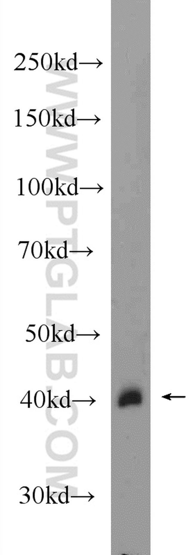 HAO1 Antibody in Western Blot (WB)