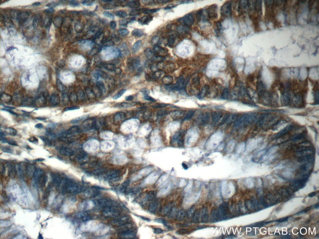 DDX58 Antibody in Immunohistochemistry (Paraffin) (IHC (P))