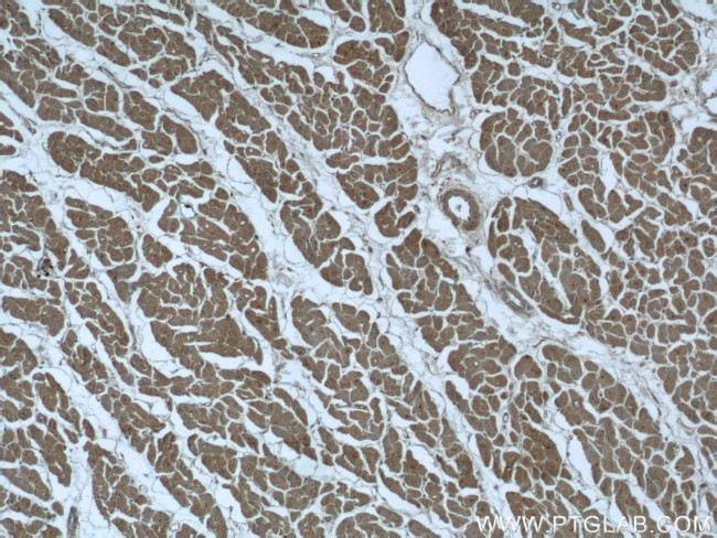 DDX58 Antibody in Immunohistochemistry (Paraffin) (IHC (P))