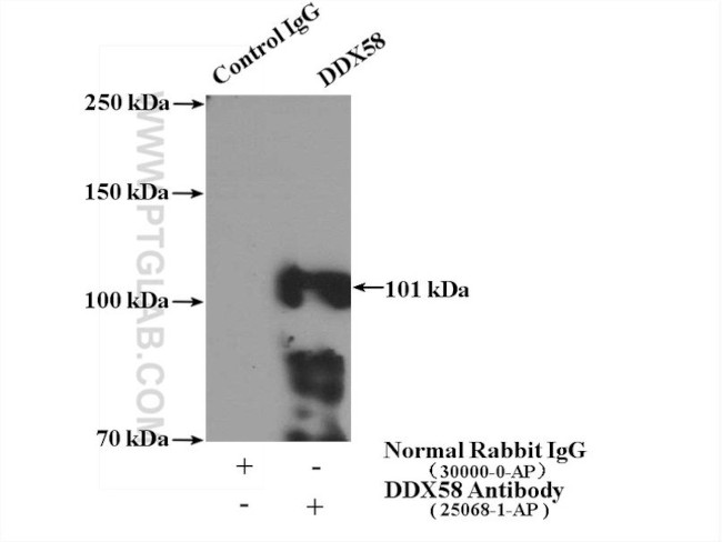 DDX58 Antibody in Immunoprecipitation (IP)