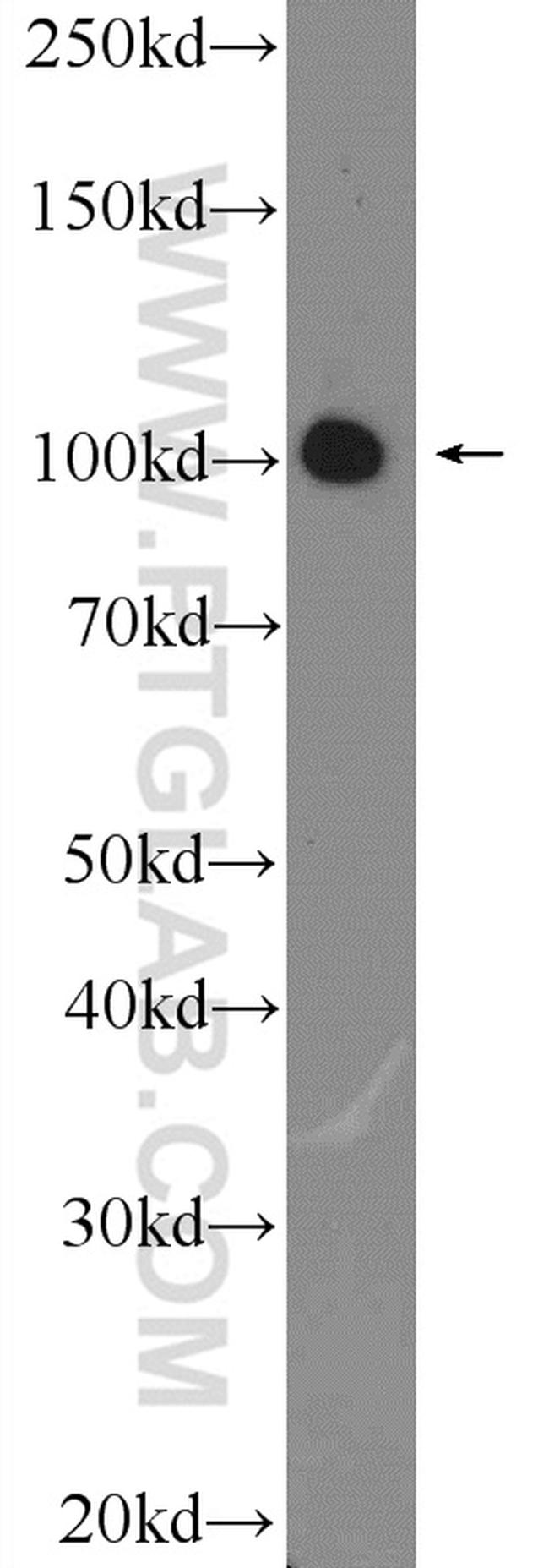 DDX58 Antibody in Western Blot (WB)