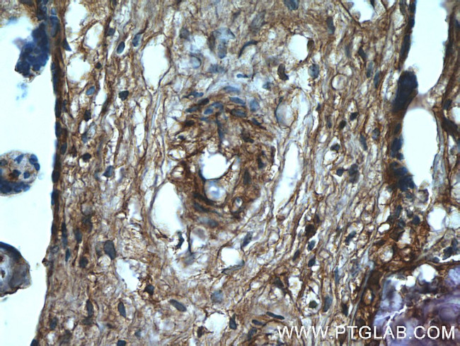 GNE Antibody in Immunohistochemistry (Paraffin) (IHC (P))