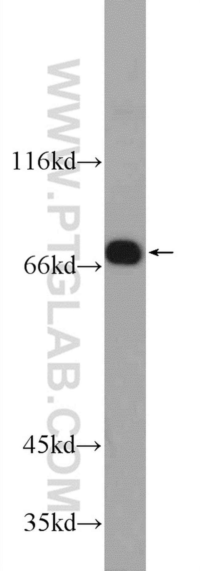 GNE Antibody in Western Blot (WB)